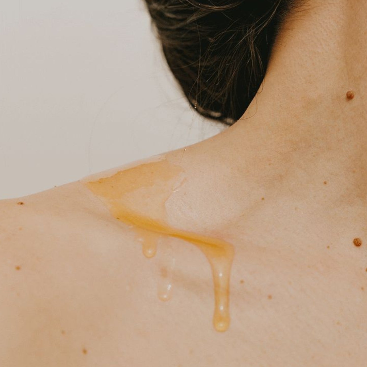 Peeling Corporal