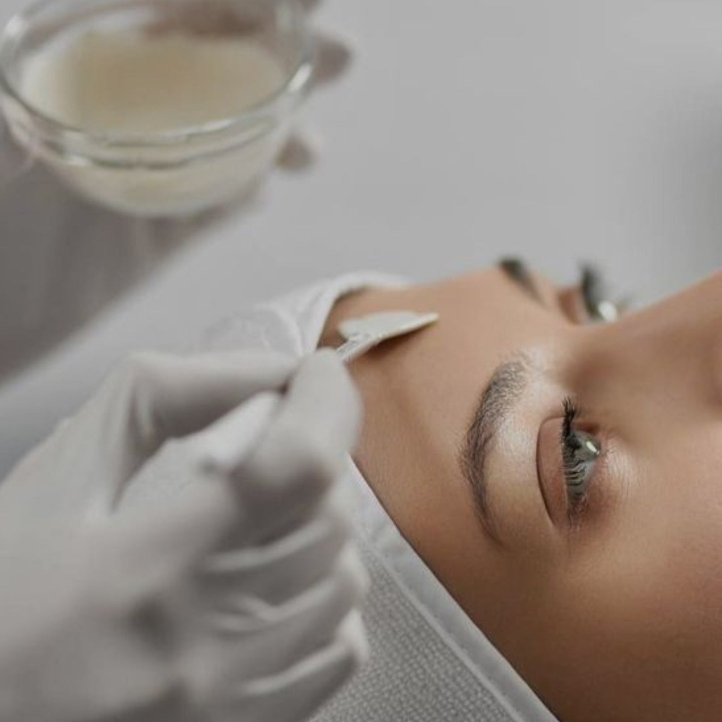 Peeling Facial