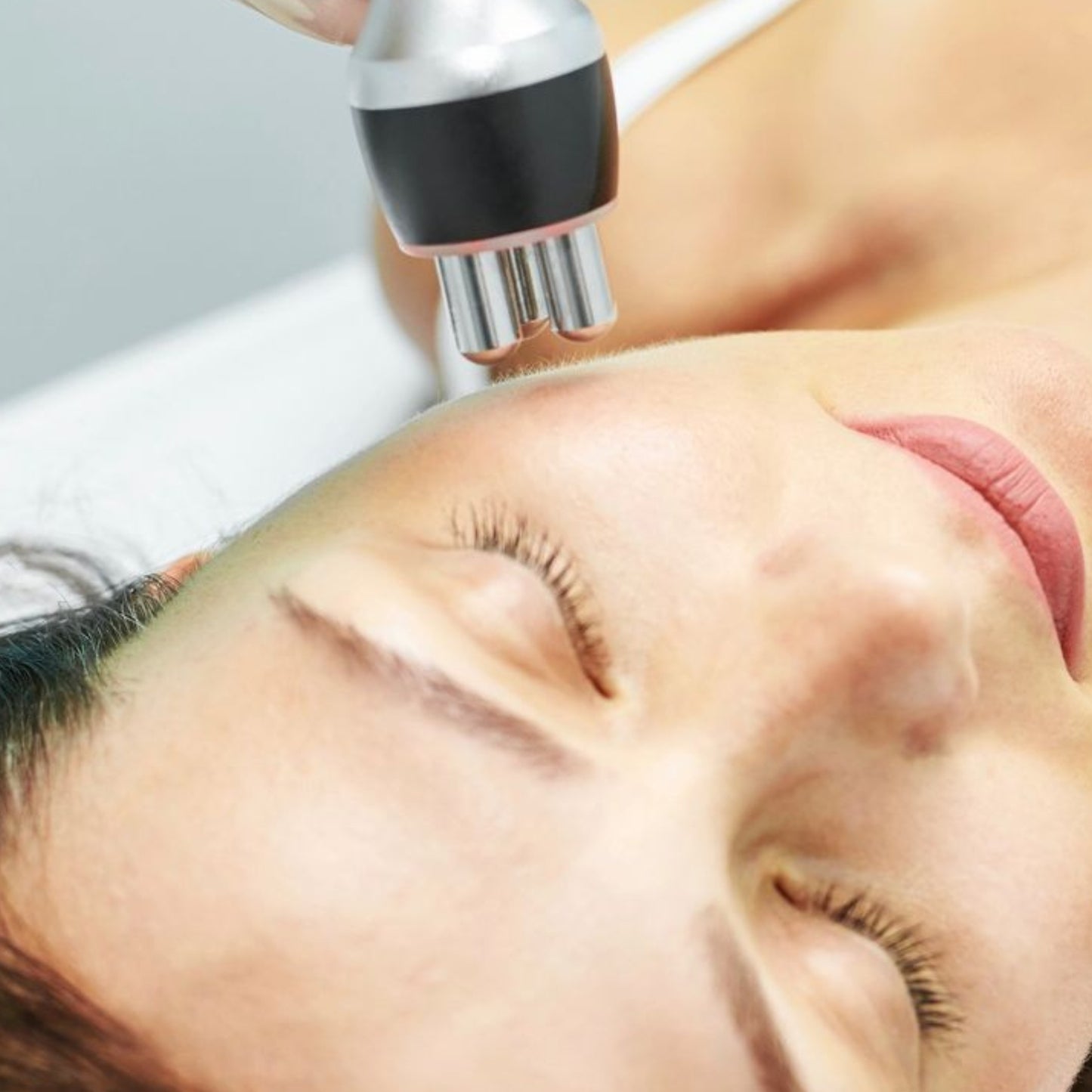 Radiofrecuencia Facial