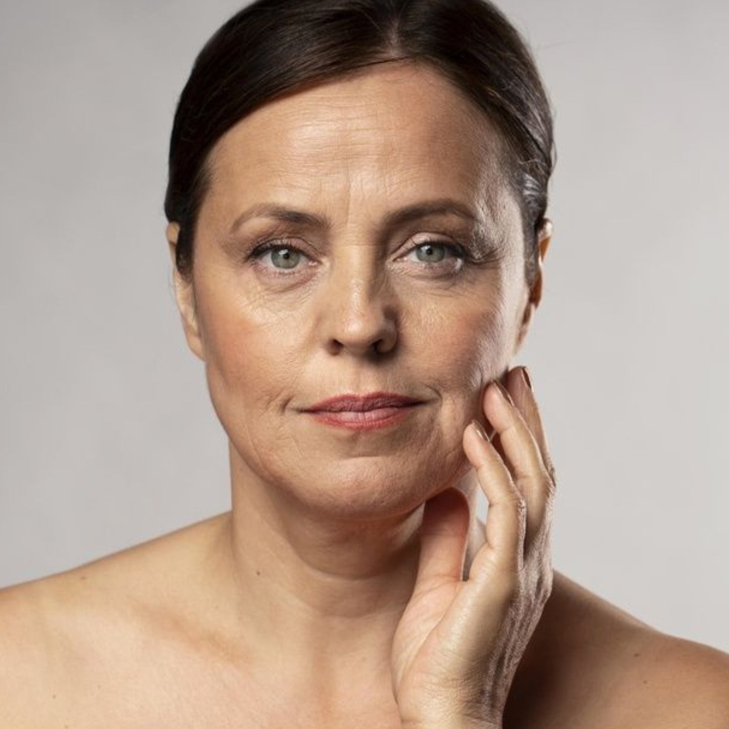 Fibroblasto Mejillas y surcos nasogenianos