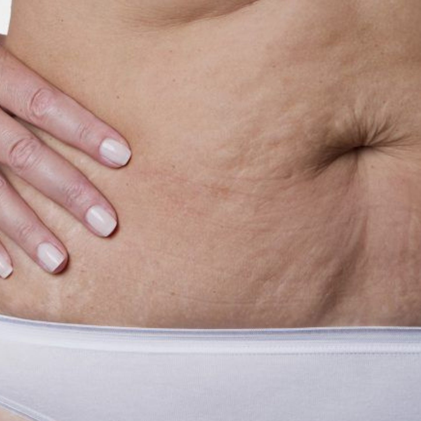 Fibroblasto abdomen