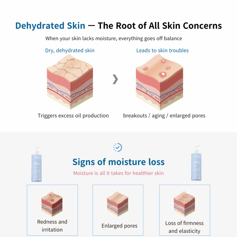 Dr. Sante Azulene Soothing Lotion – Deep Hydration & Barrier Repair for Sensitive, Dry & Irritated Skin (200 ml)