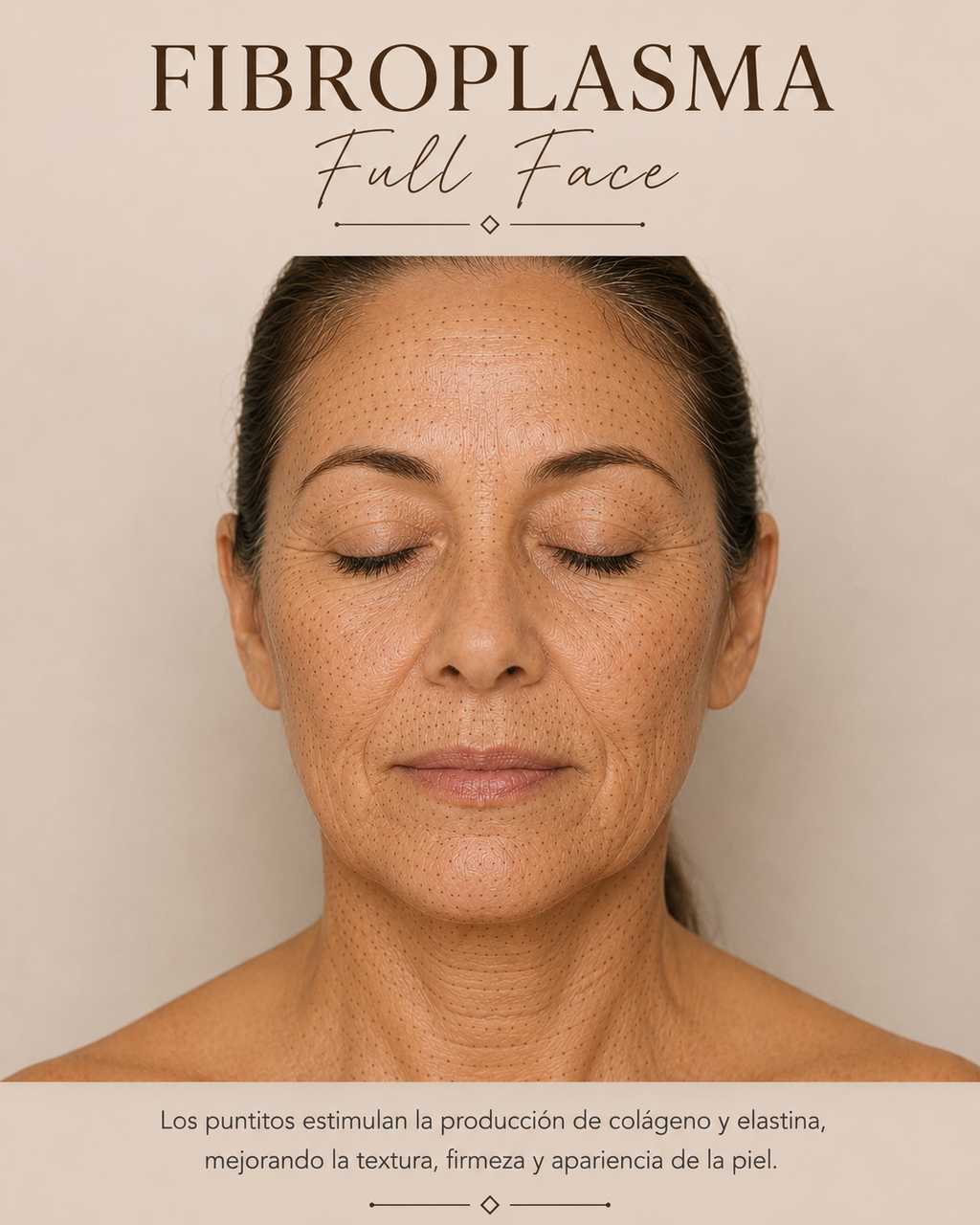 Tratamiento de plasma de fibroblastos para la piel – Rostro completo