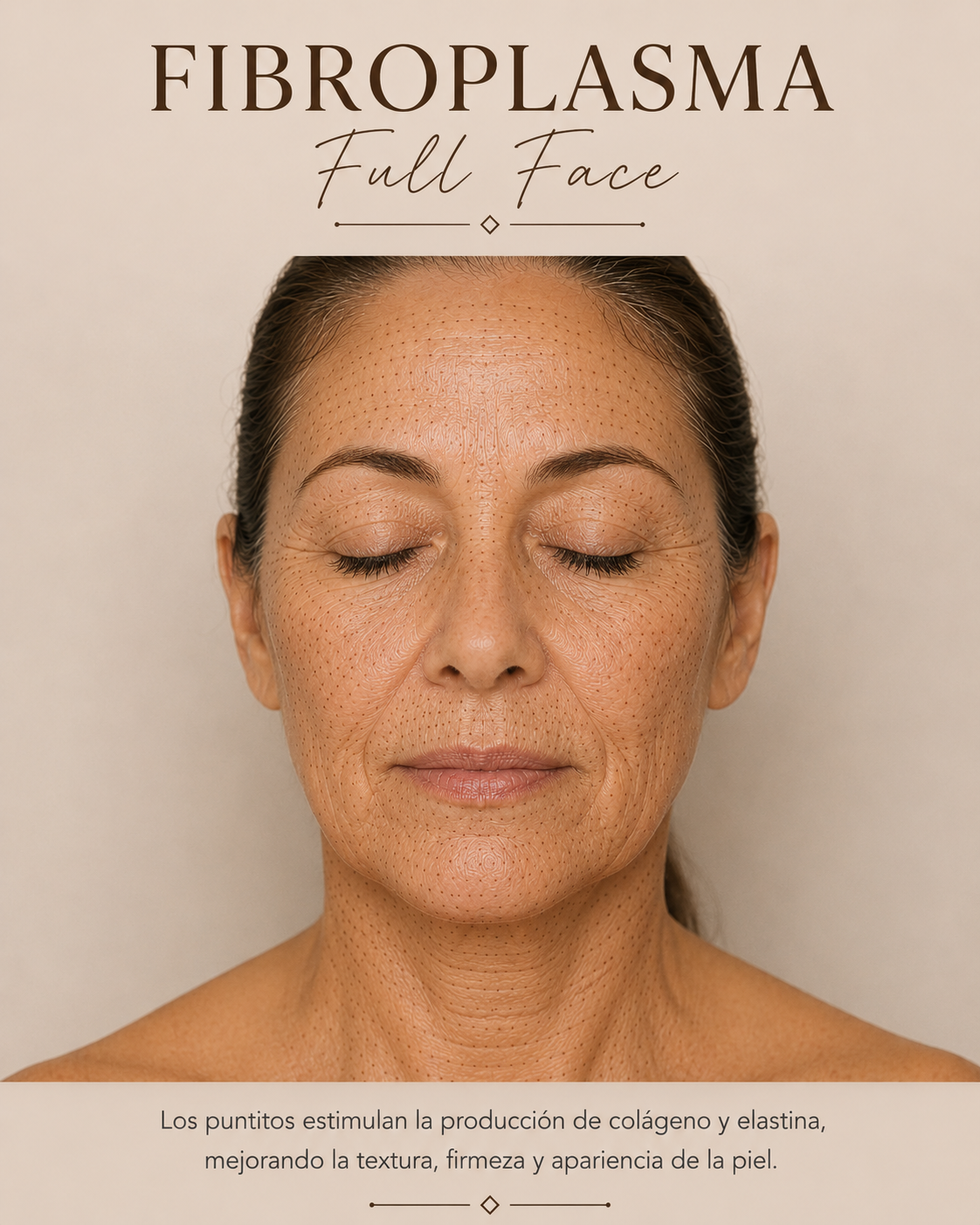 Tratamiento de plasma de fibroblastos para la piel – Rostro completo