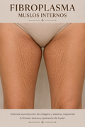 Tratamiento de fibroplasma para la cara interna de los muslos: tensado de la piel y reducción de estrías