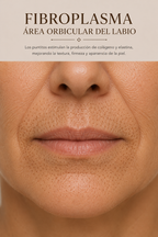 Tratamiento de código de barra labios con plasma de fibroblastos | Tensado y lifting cutáneo no quirúrgico