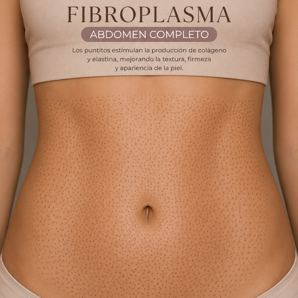Tratamiento de abdomen con plasma de fibroblastos | Tensado de piel, estrías y lifting sin cirugía