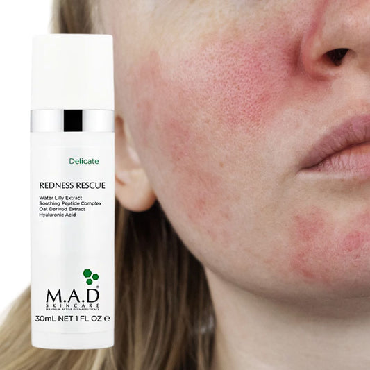 DELICATE Moisturizer Redness Rescue Gel 1 oz.