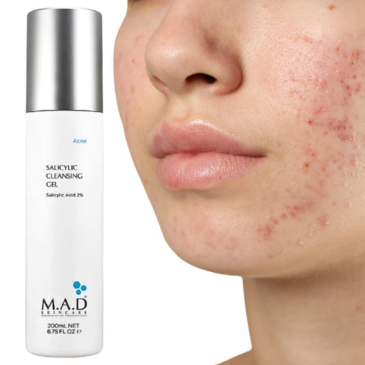 CLEANSER Acne Salicylic Gel 6.75 oz