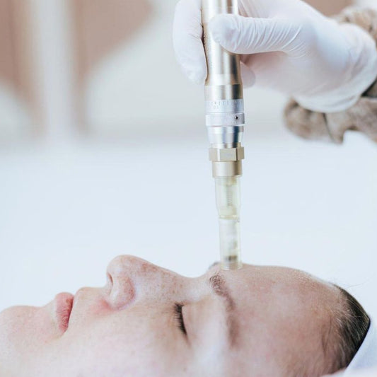 Microagujas Facial