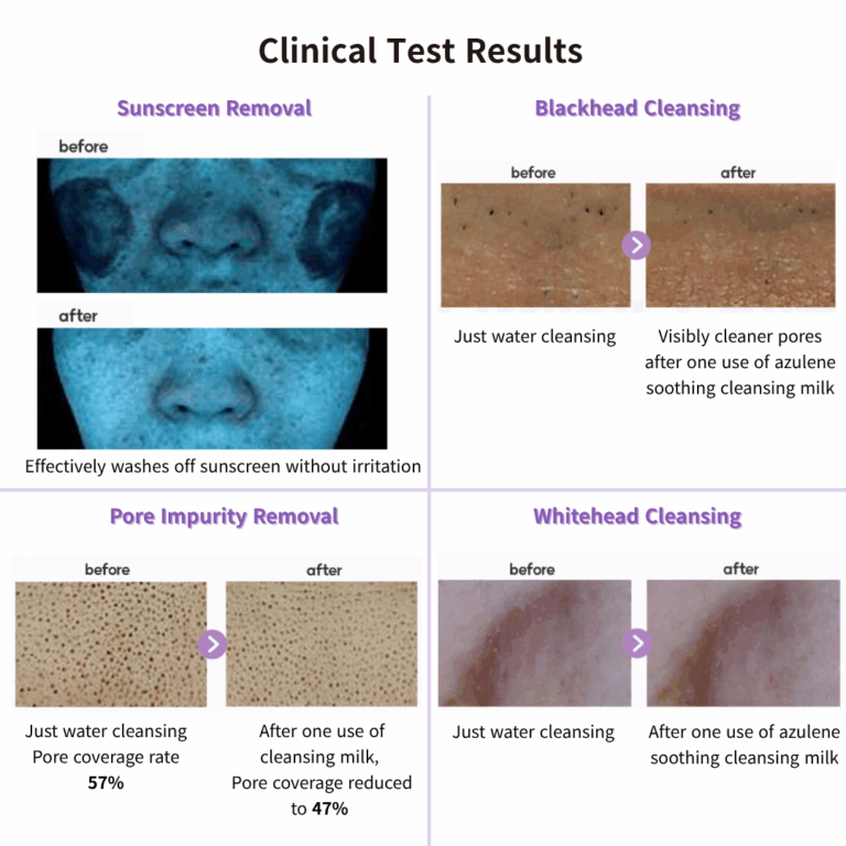 Azulene Calming Cleansing Milk – Gentle & Hydrating Facial Cleanser with Chamomile Flower Water 55%, Hyaluronic Acid & Shea Butter – pH 5.5 Barrier Care, Makeup & Sunscreen Removal for Sensitive Skin