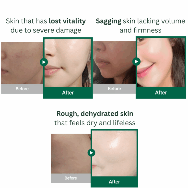 Tender Garden Skin Renewal Set – Advanced Skin Regeneration & Deep Hydration Treatment with 99% Camellia PDRN, Exosomes & Water-Glow Tox Serum – Restores Glow, Repairs Skin Barrier & Improves Texture