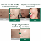 Tender Garden Skin Renewal Set – Advanced Skin Regeneration & Deep Hydration Treatment with 99% Camellia PDRN, Exosomes & Water-Glow Tox Serum – Restores Glow, Repairs Skin Barrier & Improves Texture