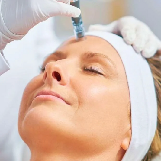 Dna Salmón Tratamiento antienvejecimiento regenerativo Microneedling